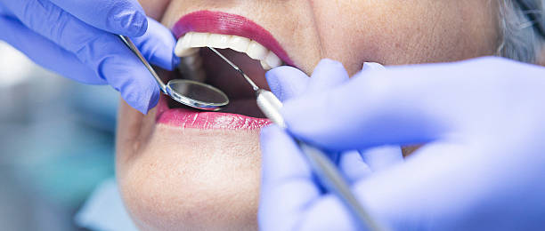 Best Urgent Tooth Repair  in Nroe City, MO